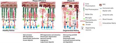 Pluripotent Stem Cells for the Treatment of Retinal Degeneration: Current Strategies and Future Directions